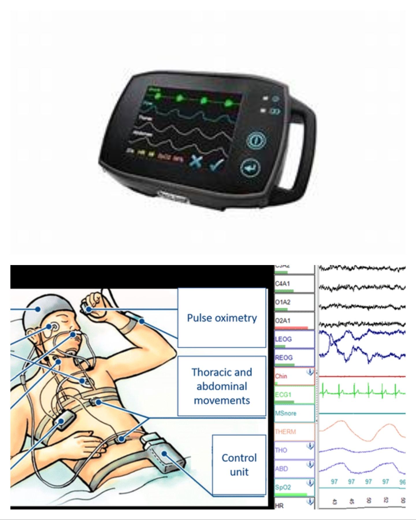 Sonomedic Polysomnography System